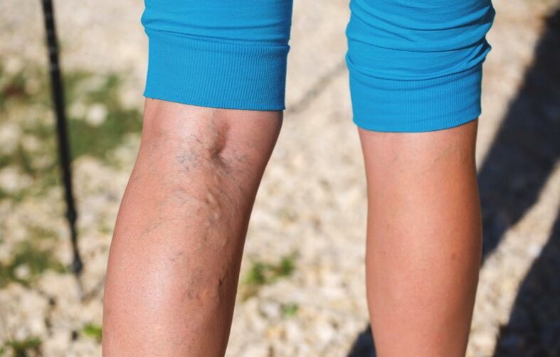 Danos nas extremidades inferiores